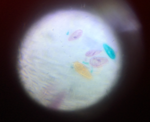 Paramecios (protozoos) magnificados con microscopio casero.